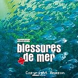 Blessures de mer